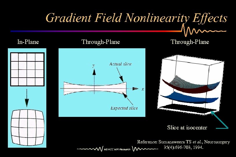 Gradient Field Nonlinearity Effects In-Plane Through-Plane Slice at isocenter MDACC MR Research Reference: Sumanaweera