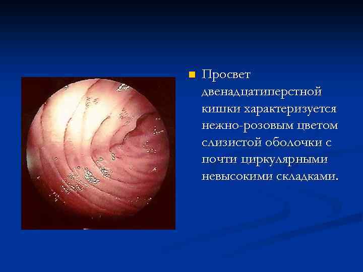n Просвет двенадцатиперстной кишки характеризуется нежно-розовым цветом слизистой оболочки с почти циркулярными невысокими складками.