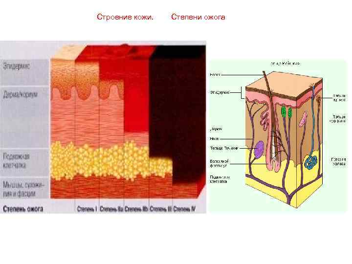 Степени кожи. Строение кожи при ожоге.