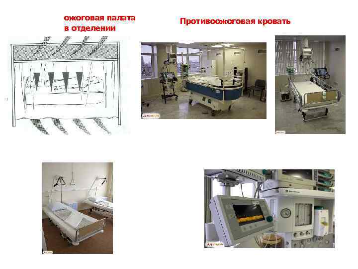 ожоговая палата в отделении Противоожоговая кровать 