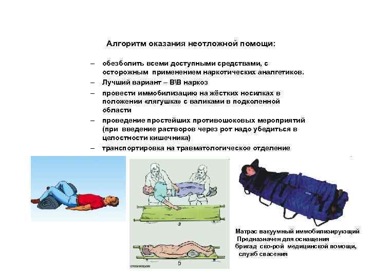 Алгоритм оказания неотложной помощи: – обезболить всеми доступными средствами, с осторожным применением наркотических аналгетиков.
