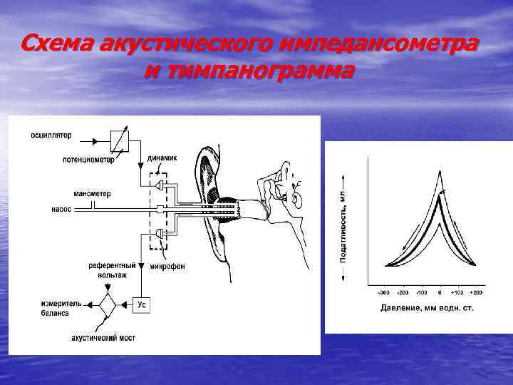 Схема акустического импедансометра и тимпанограмма 