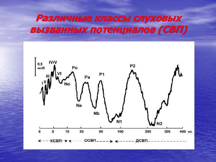 Различные классы слуховых вызванных потенциалов (СВП) 