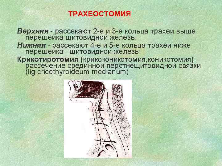 Операция по удалению щитовидной железы фото