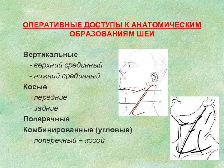 Операции на щитовидной железе презентация