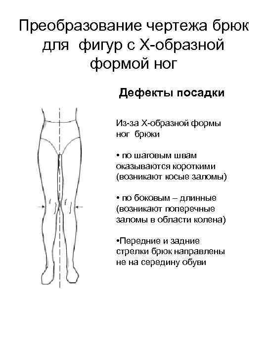Преобразование чертежа брюк для фигур с Х-образной формой ног Дефекты посадки Из-за Х-образной формы