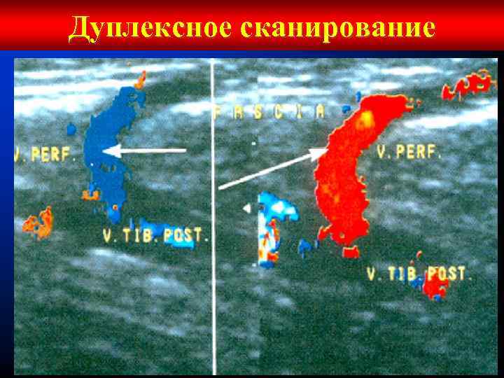 Дуплексное сканирование 
