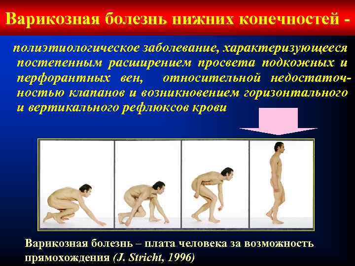 Варикозная болезнь нижних конечностей полиэтиологическое заболевание, характеризующееся постепенным расширением просвета подкожных и перфорантных вен,