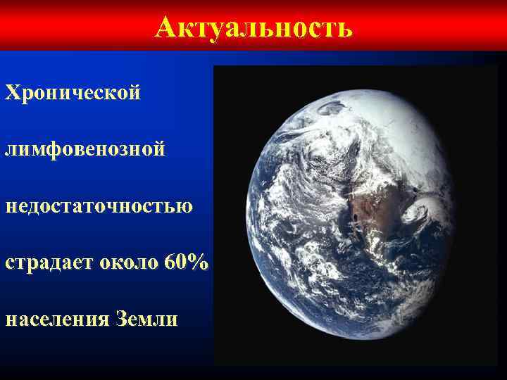 Актуальность Хронической лимфовенозной недостаточностью страдает около 60% населения Земли 
