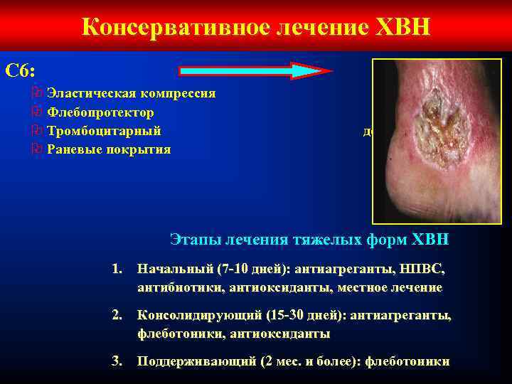 Консервативное лечение ХВН С 6: O Эластическая компрессия O Флебопротектор O Тромбоцитарный O Раневые