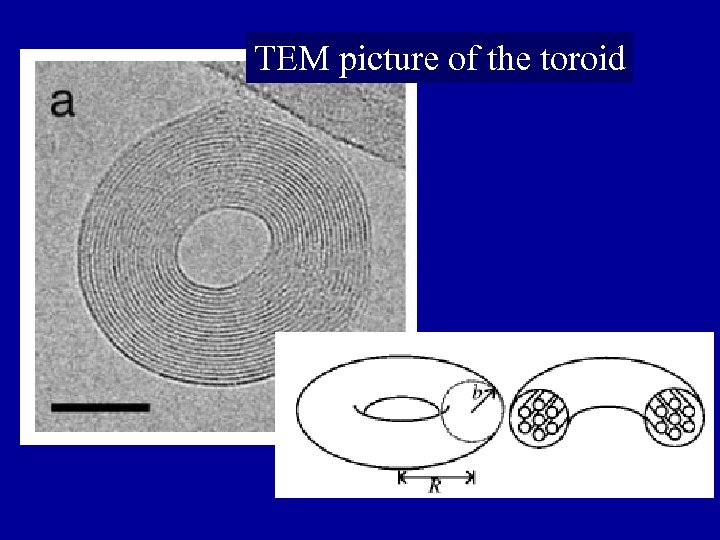 TEM picture of the toroid 