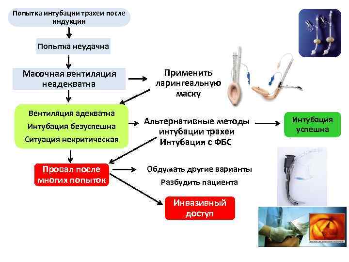 Попытка интубации трахеи после индукции Попытка неудачна Масочная вентиляция неадекватна Применить ларингеальную маску Вентиляция