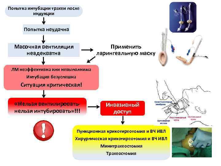 Попытка интубации трахеи после индукции Попытка неудачна Применить ларингеальную маску Масочная вентиляция неадекватна ЛМ