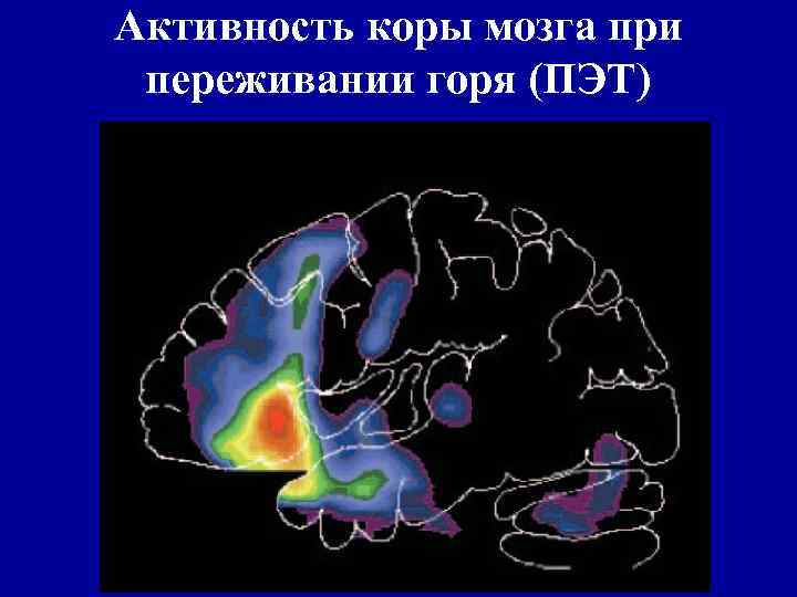 Активность коры мозга при переживании горя (ПЭТ) 