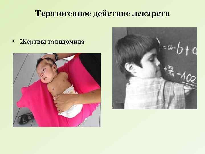 Тератогенное действие лекарств • Жертвы талидомида 
