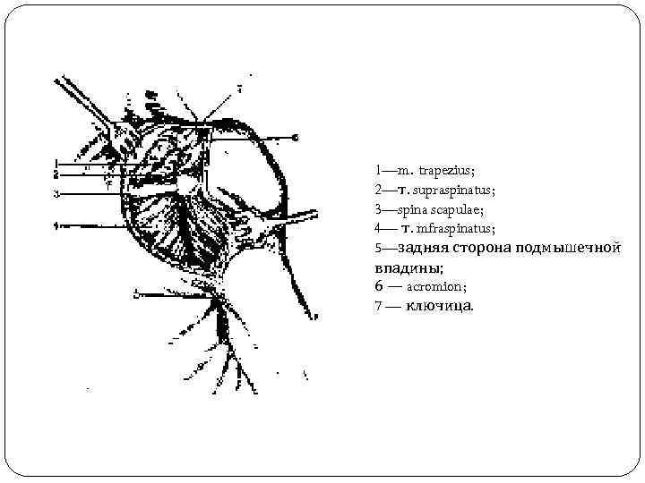 1—m. trapezius; 2—т. supraspinatus; 3—spina scapulae; 4— т. mfraspinatus; 5—задняя сторона подмышечной впадины; 6