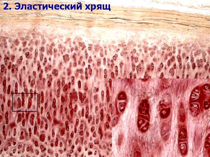 2. Эластический хрящ 