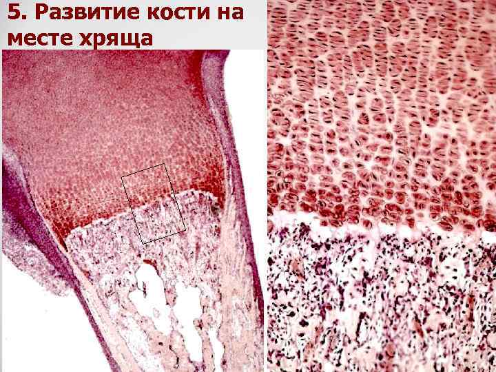 Развитие кости на месте хряща рисунок