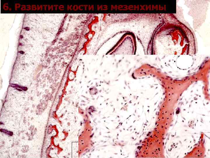 6. Развитите кости из мезенхимы 