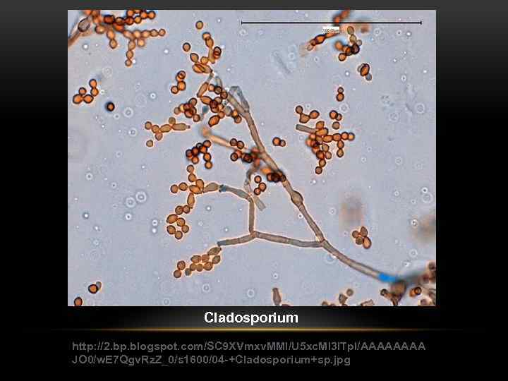 Cladosporium http: //2. bp. blogspot. com/SC 9 XVmxv. MMI/U 5 xc. Ml 3 l.