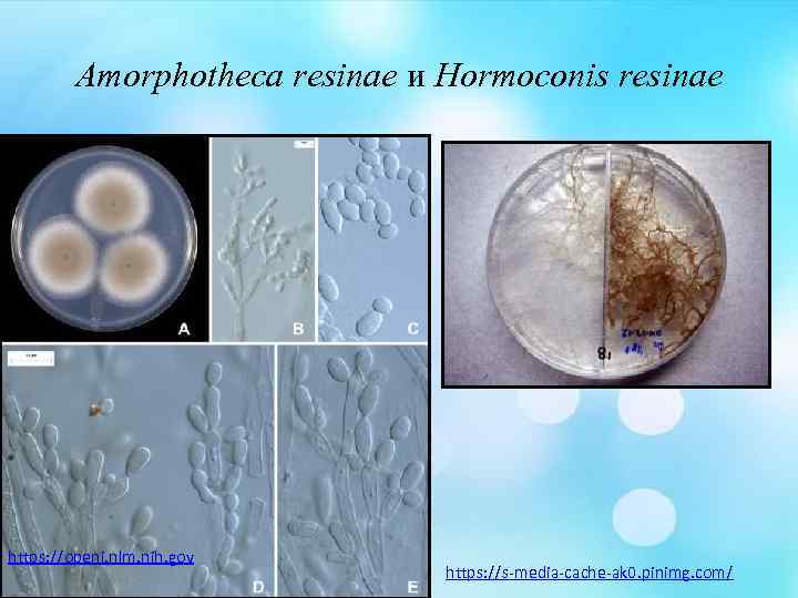 Amorphotheca resinae и Hormoconis resinae https: //openi. nlm. nih. gov https: //s-media-cache-ak 0. pinimg.