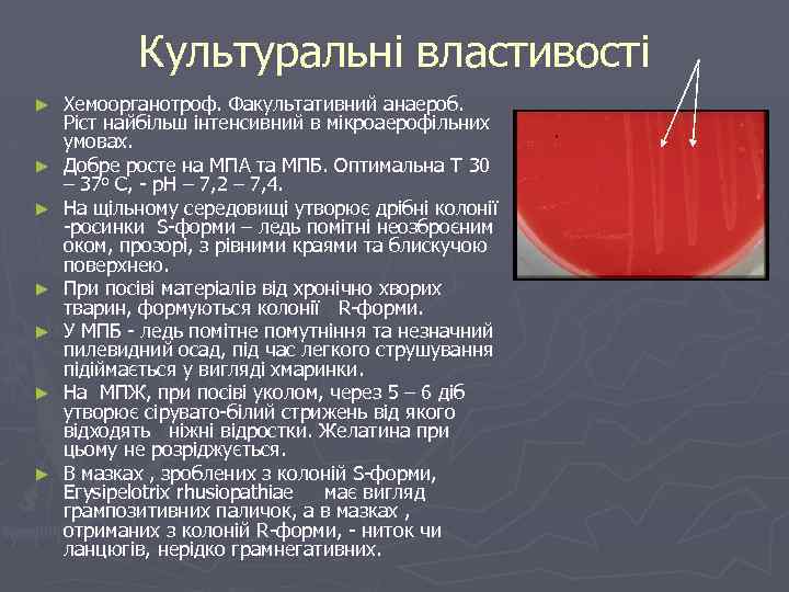 Культуральні властивості ► ► ► ► Хемоорганотроф. Факультативний анаероб. Ріст найбільш інтенсивний в мікроаерофільних