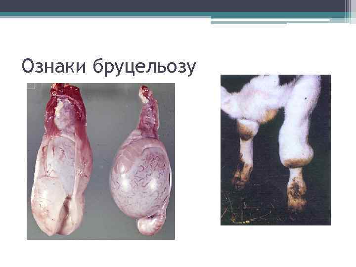 Ознаки бруцельозу 