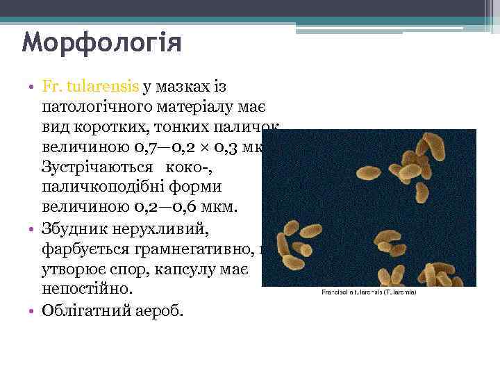 Морфологія • Fr. tularensis у мазках із патологічного матеріалу має вид коротких, тонких паличок