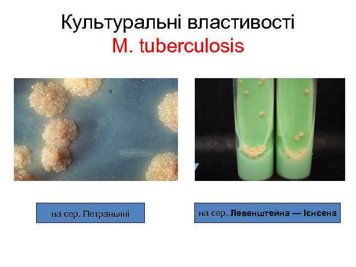 Культуральні властивості М. tuberculosis на сер. Петраньяні на сер. Левенштейна — Ієнсена 
