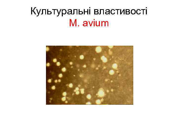 Культуральні властивості М. avium 
