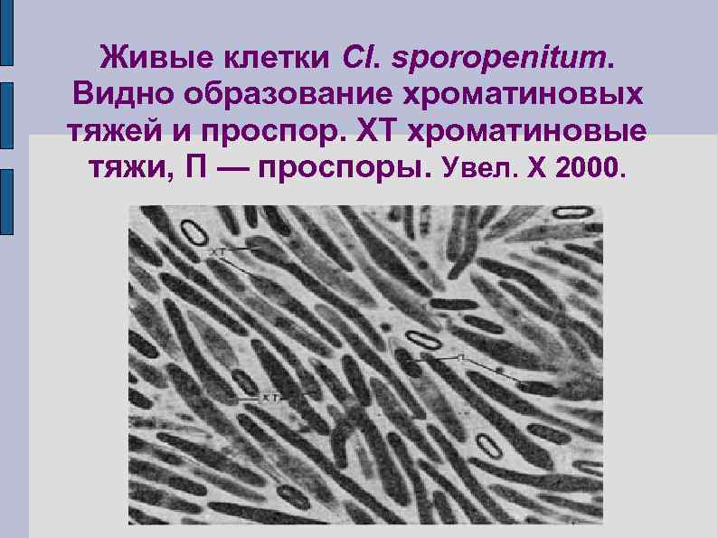 Живые клетки Cl. sporopenitum. Видно образование хроматиновых тяжей и проспор. XT хроматиновые тяжи, П