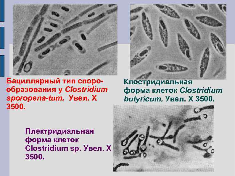 Бациллярный тип спорообразования у Сlоstridium sporopena-tum. Увел. X 3500. Плектридиальная форма клеток Clostridium sp.