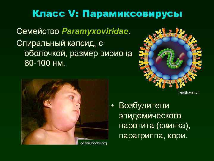 Класс V: Парамиксовирусы Семейство Paramyxoviridae. Спиральный капсид, с оболочкой, размер вириона 80 -100 нм.