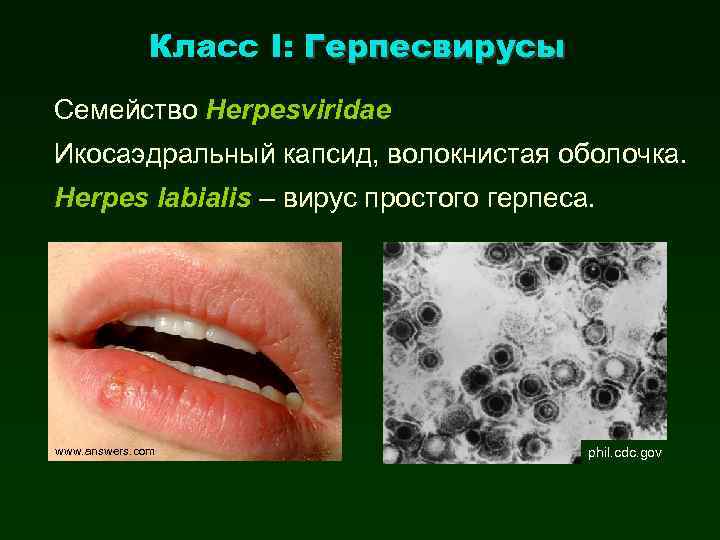 Класс I: Герпесвирусы Семейство Herpesviridae Икосаэдральный капсид, волокнистая оболочка. Herpes labialis – вирус простого