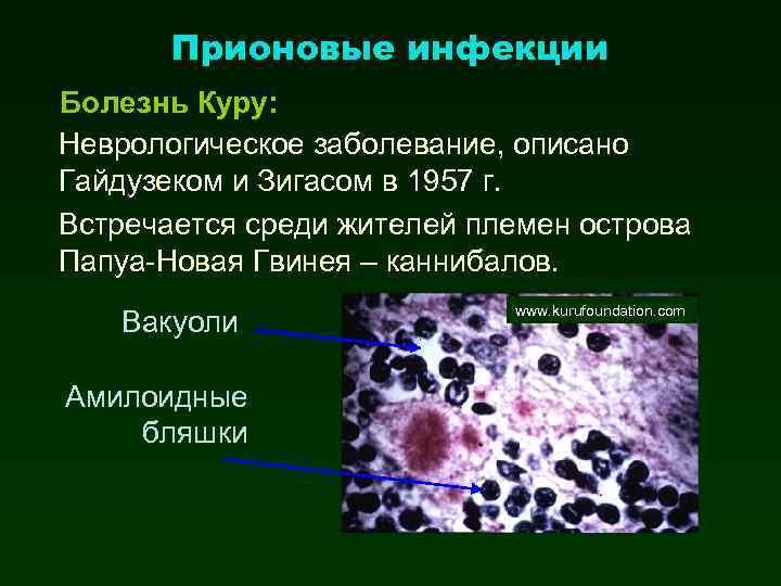 Болезнь куру презентация