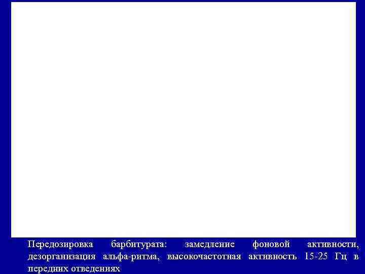 Передозировка барбитурата: замедление фоновой активности, дезорганизация альфа-ритма, высокочастотная активность 15 -25 Гц в передних