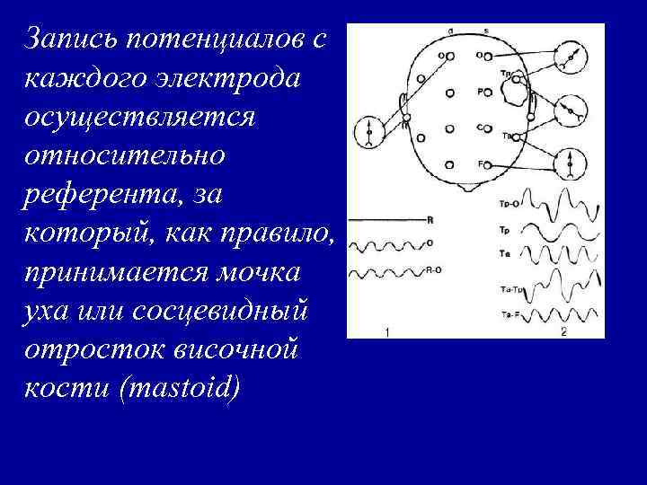 Запись потенциалов с каждого электрода осуществляется относительно референта, за который, как правило, принимается мочка