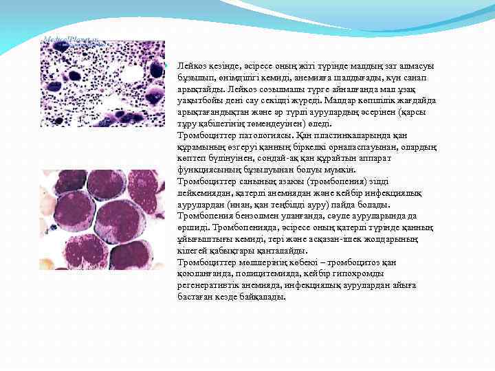  Лейкоз кезінде, әсіресе оның жіті түрінде малдың зат алмасуы бұзылып, өнімділігі кемиді, анемияға
