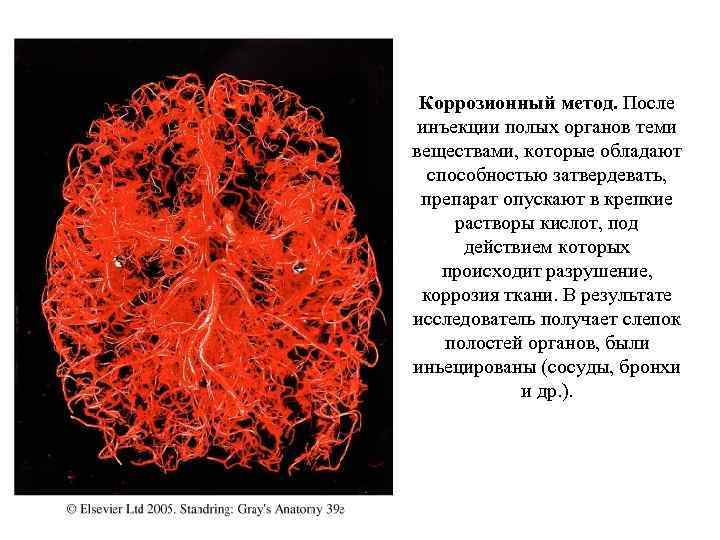 Коррозионный метод. После инъекции полых органов теми веществами, которые обладают способностью затвердевать, препарат опускают