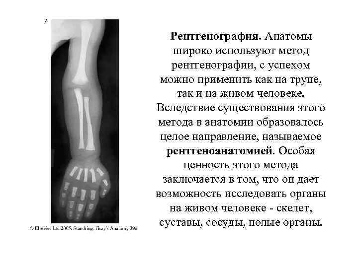 Рентгенография. Анатомы широко используют метод рентгенографии, с успехом можно применить как на трупе, так