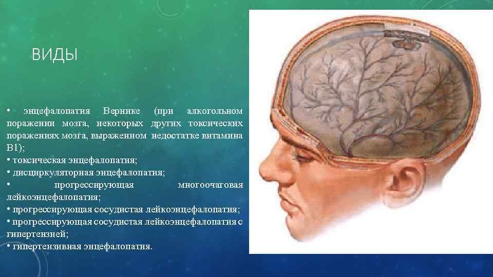 Поражение мозга лечение