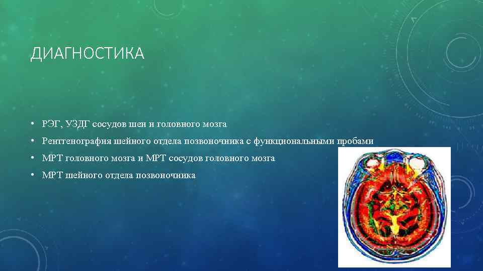 ДИАГНОСТИКА • РЭГ, УЗДГ сосудов шеи и головного мозга • Рентгенография шейного отдела позвоночника