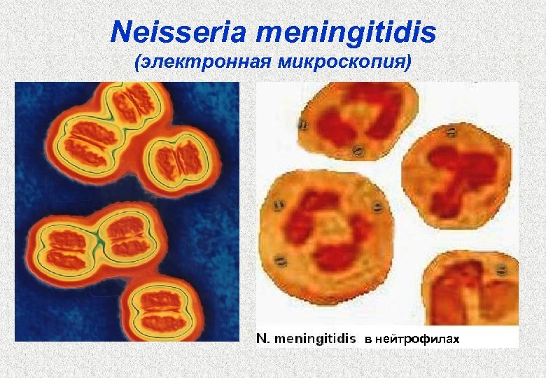 Neisseria meningitidis (электронная микроскопия) в нейтрофилах 