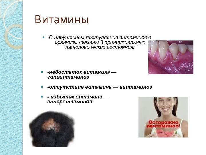 Витамины С нарушением поступления витаминов в организм связаны 3 принципиальных патологических состояния: -недостаток витамина