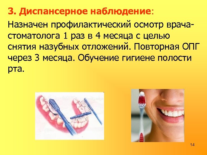 3. Диспансерное наблюдение: Назначен профилактический осмотр врачастоматолога 1 раз в 4 месяца с целью