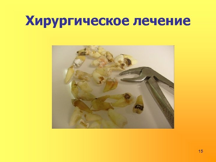 Хирургическое лечение 15 