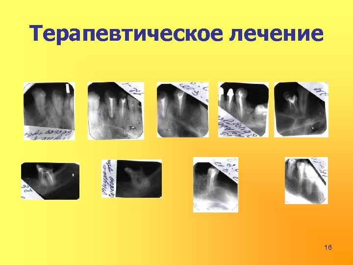 Терапевтическое лечение 16 