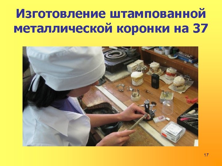 Изготовление штампованной металлической коронки на 37 17 