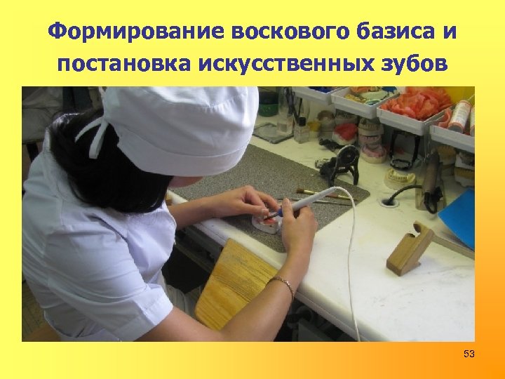 Формирование воскового базиса и постановка искусственных зубов 53 