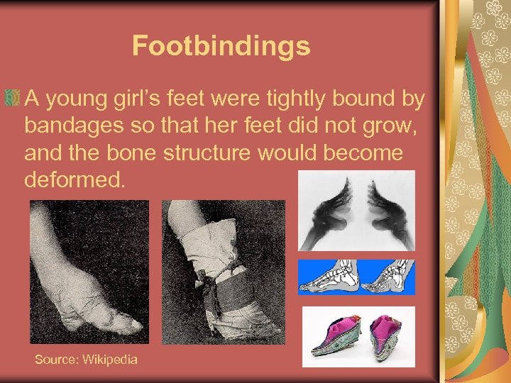 Footbindings A young girl’s feet were tightly bound by bandages so that her feet